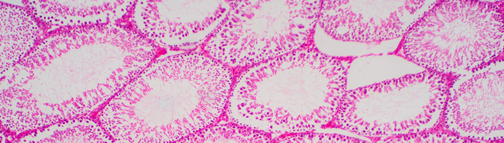 Human sperm in the testis morphology under microscope.