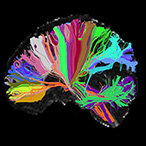 Long distance connections in the human brain. Different colors indicate wiring associated with different brain structures.