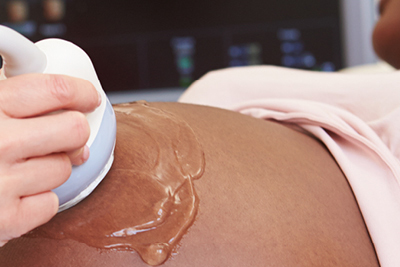 A technician performing an ultrasound on a pregnant woman’s belly.